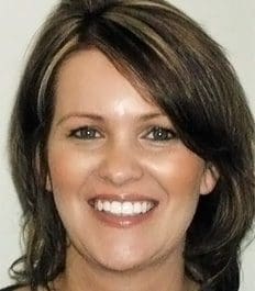 After - Overbite restoration