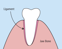 a tooth being taken out from the tooth socket